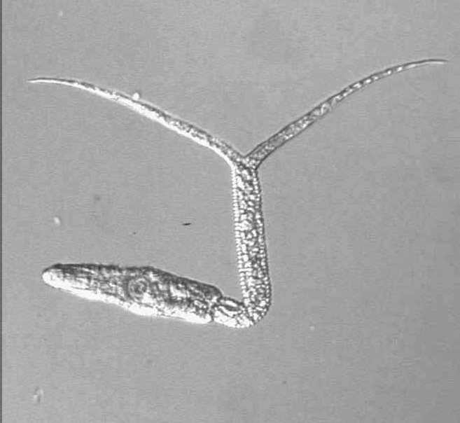 Diplostomum cercariae