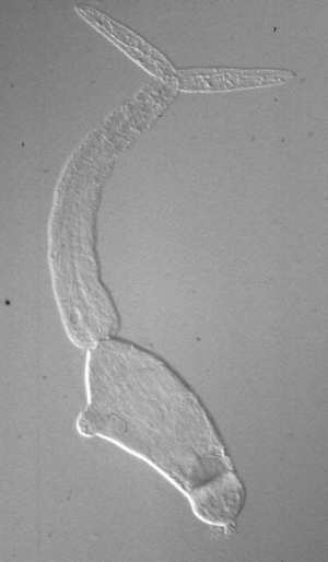 Schistosoma mansoni cercariae